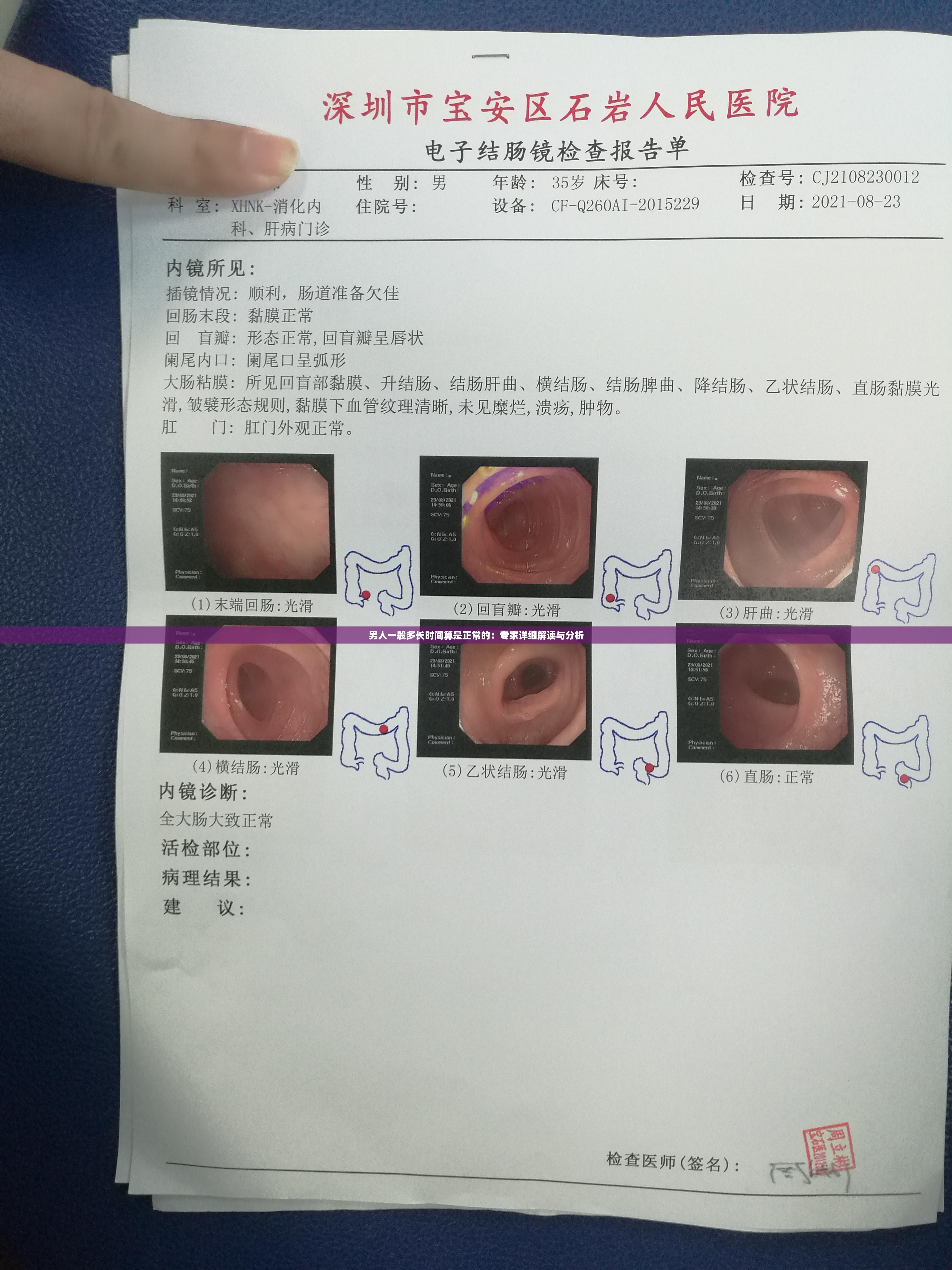 男人一般多长时间算是正常的：专家详细解读与分析